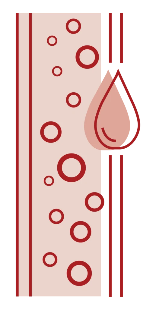 PRP Treamtent (Platelet rich plasma)