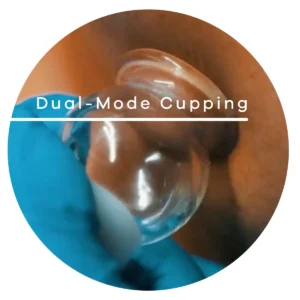 Dual-mode Cuppling helps to achieve glass skin