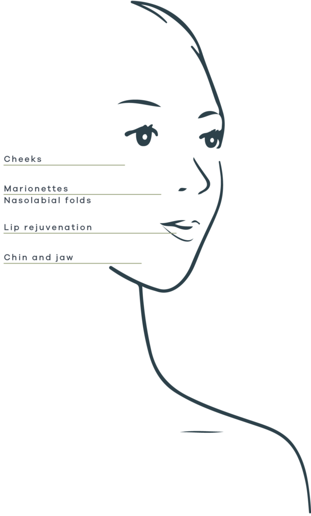Common filler sites, including lip filler and cheek filler.