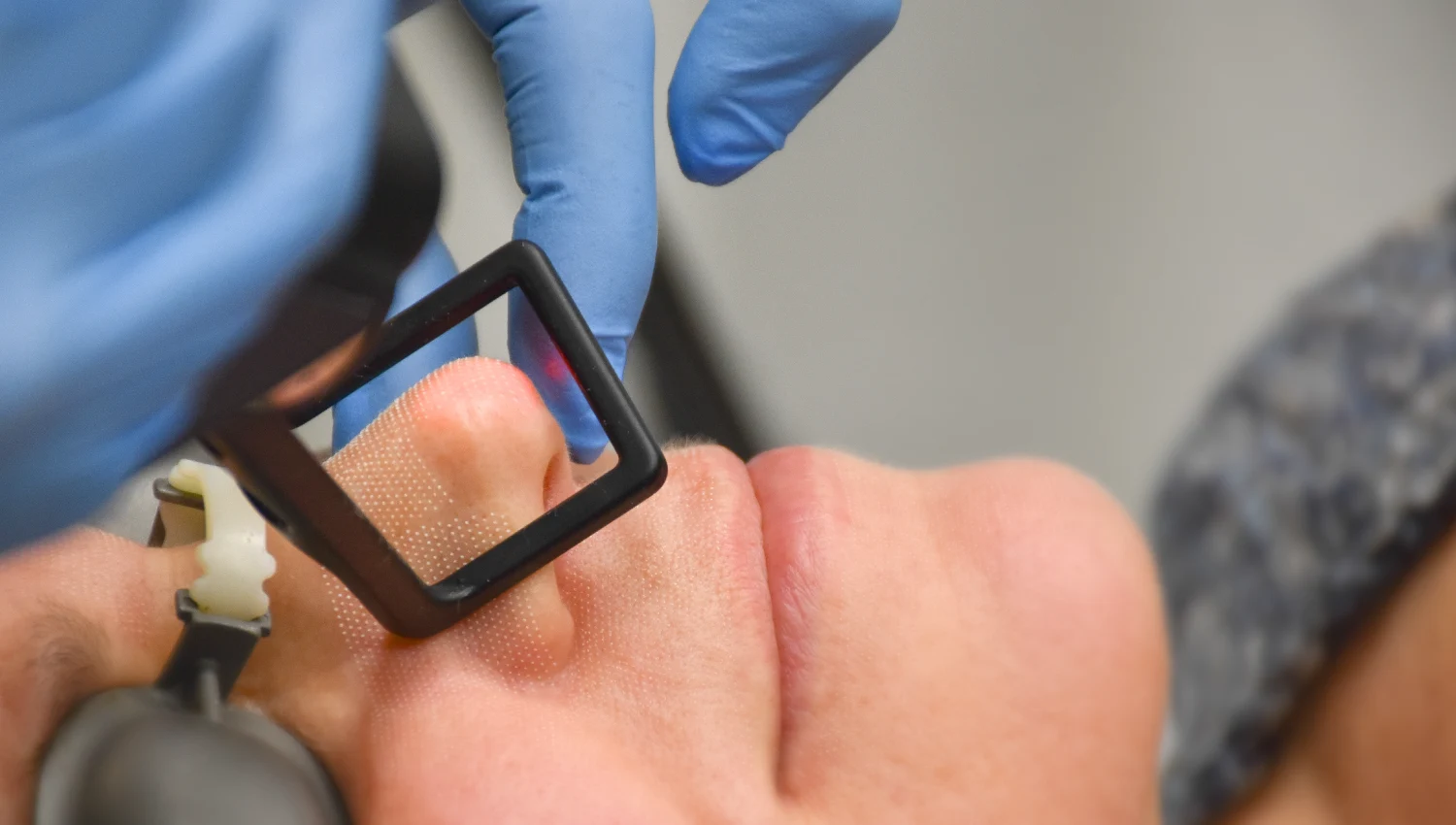 Clinician in blue gloves positions a small rectangular black frame near a patient’s mouth during a medical/dental procedure.