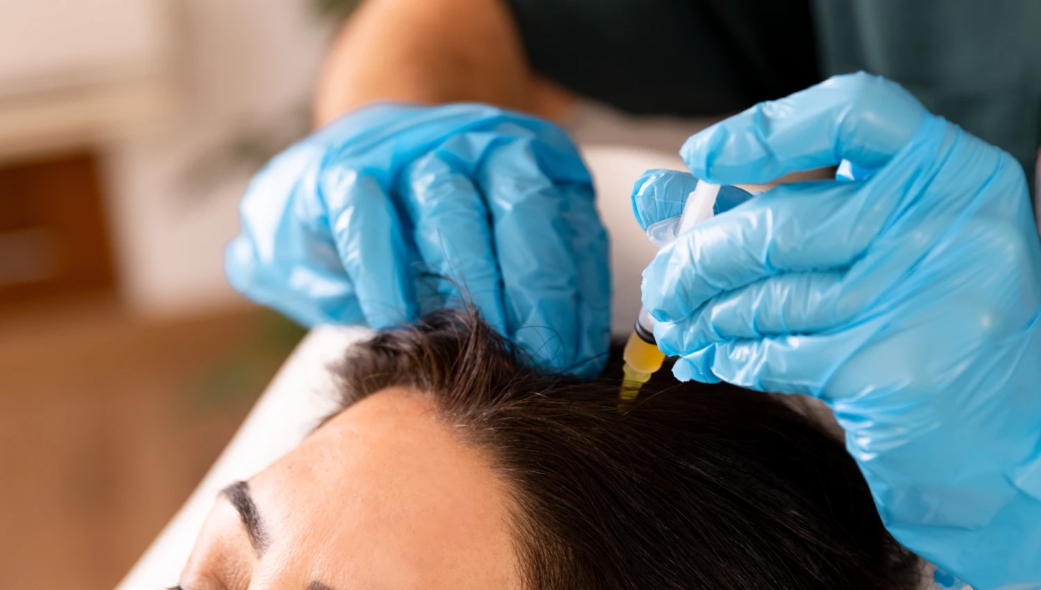 Treatments for Hairloss