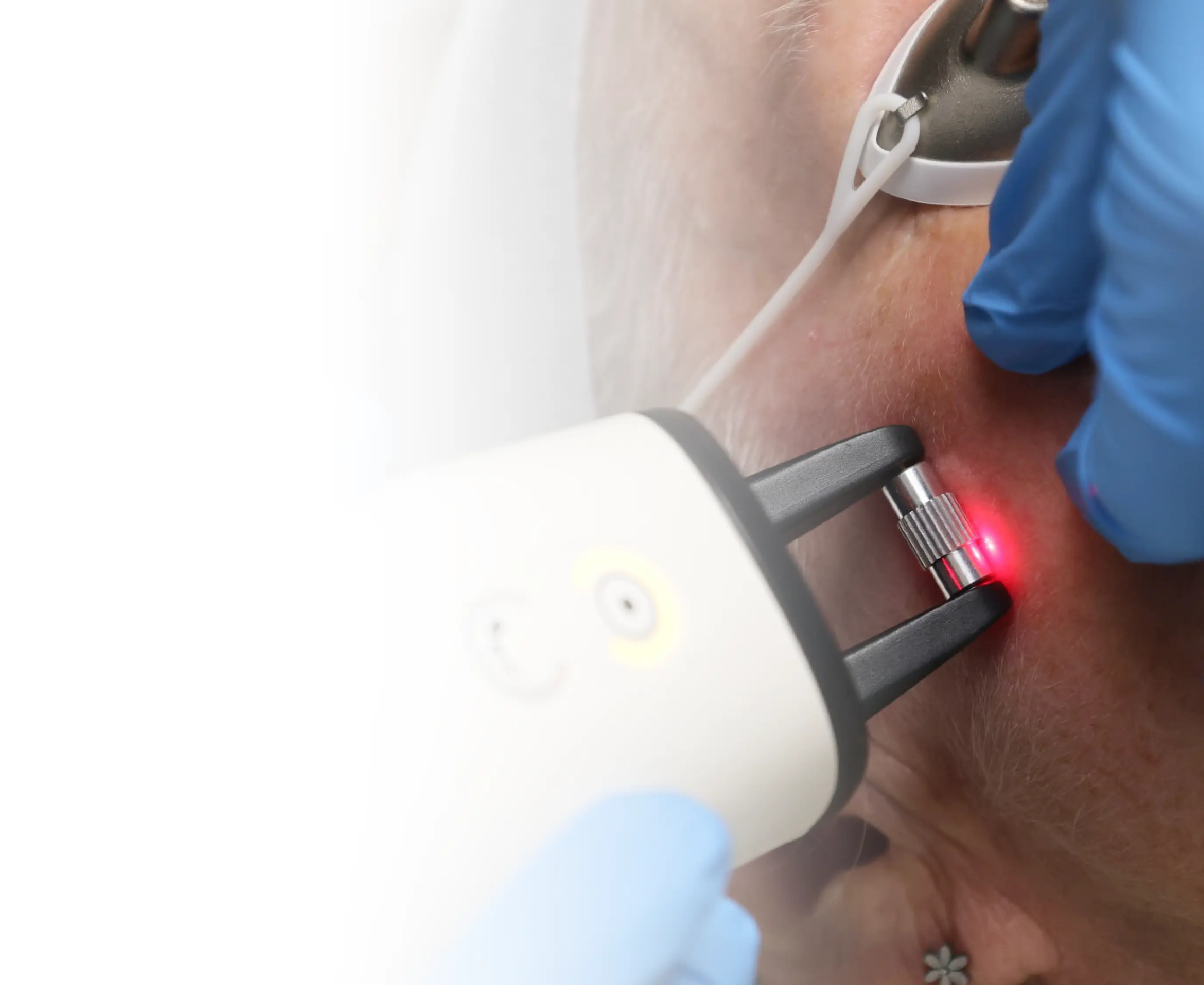 Real Anue Treatments