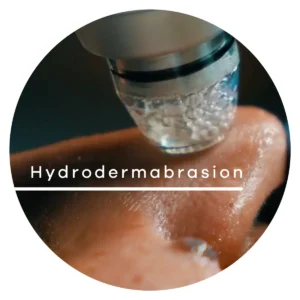 Hydrodermabrasion with diamond tips for glass skin