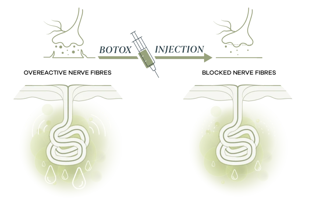 Medical illustration of dual tubing lines delivering fluids into a body with droplets and a supervising machine above (infusion concept).