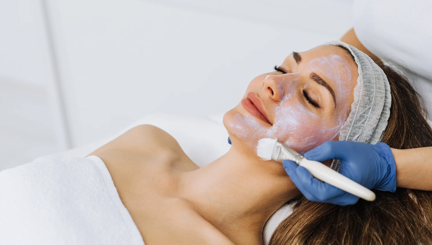 Chemical peel