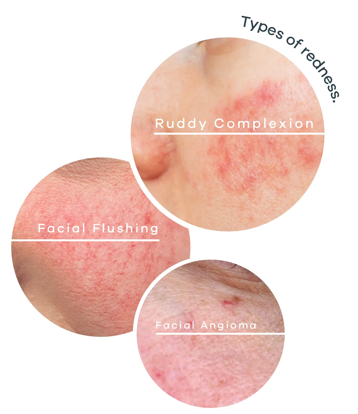 redness-causes-3 - Anue