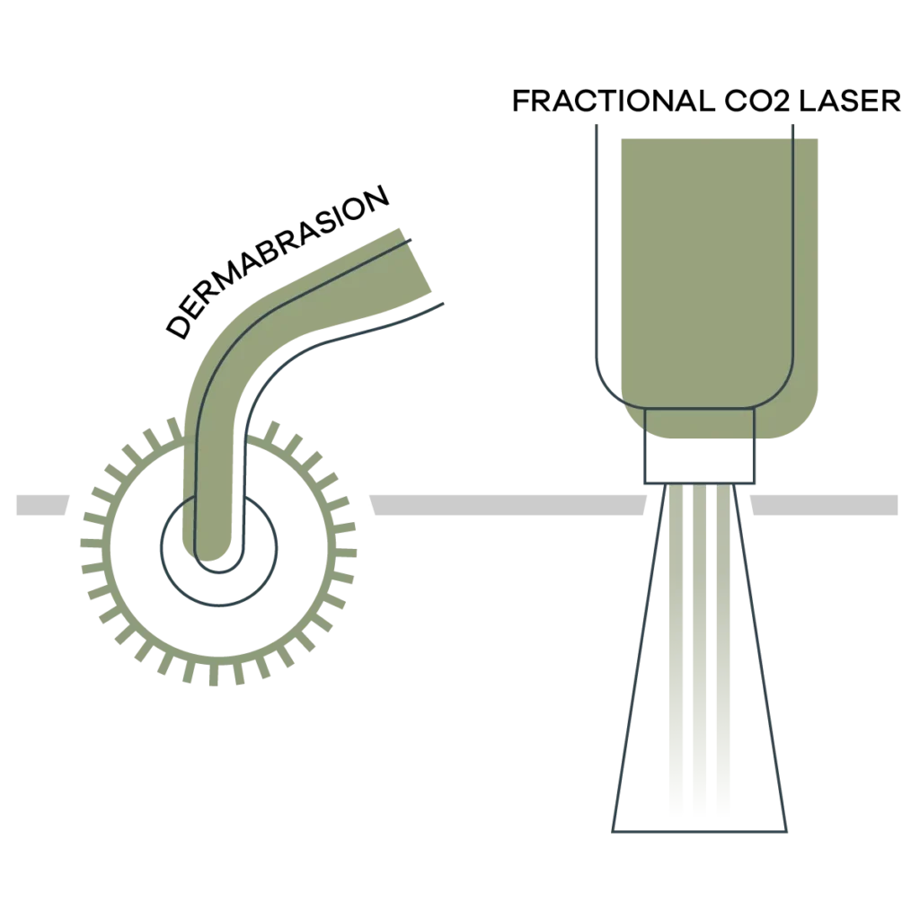 rhinophyma-treatment - Anue Stylized green microscope with a circular focus knob on the left and a tall adjustable arm on the right.