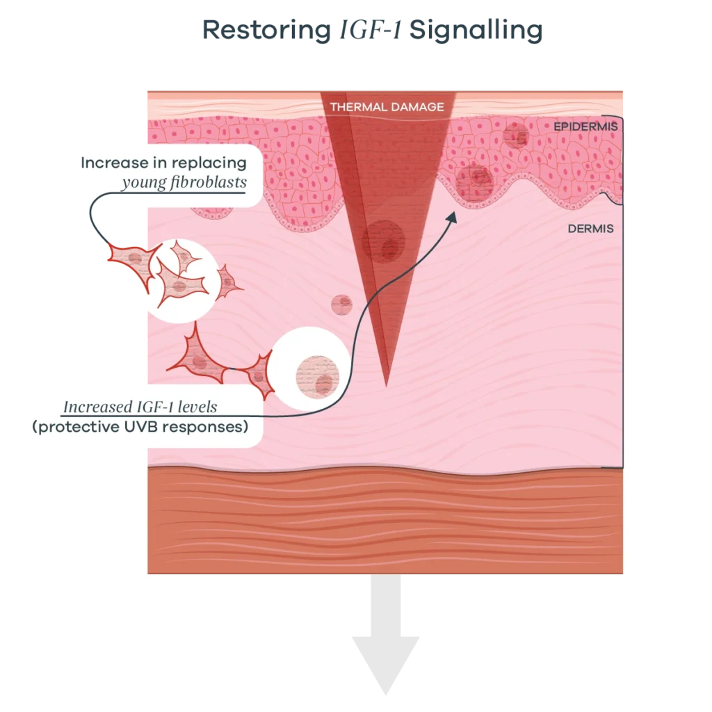 Cross-section of skin showing UV-induced damage and a treatment pathway restoring IGF-1 and young fibroblast replacement.
