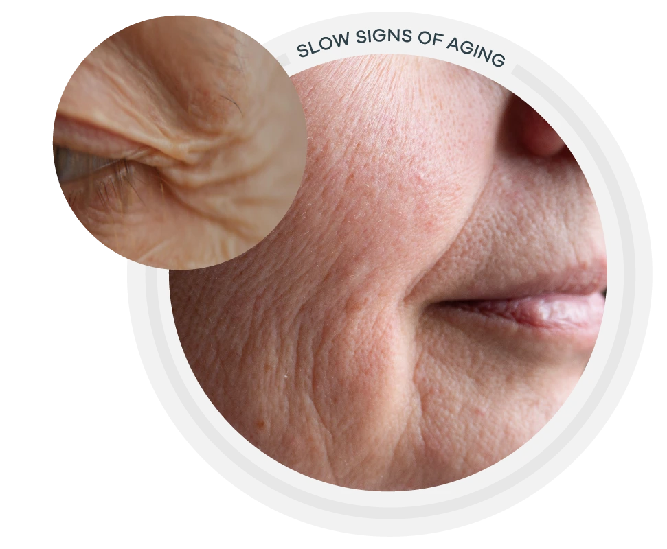 sunekos treatment sites, image of wrinkly eye skin, image of mouth
