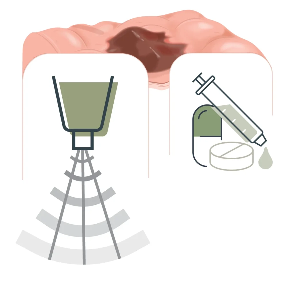 Hyperpigmentation treatment options